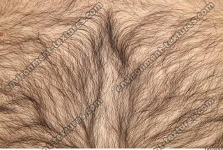 human skin hairy 0005